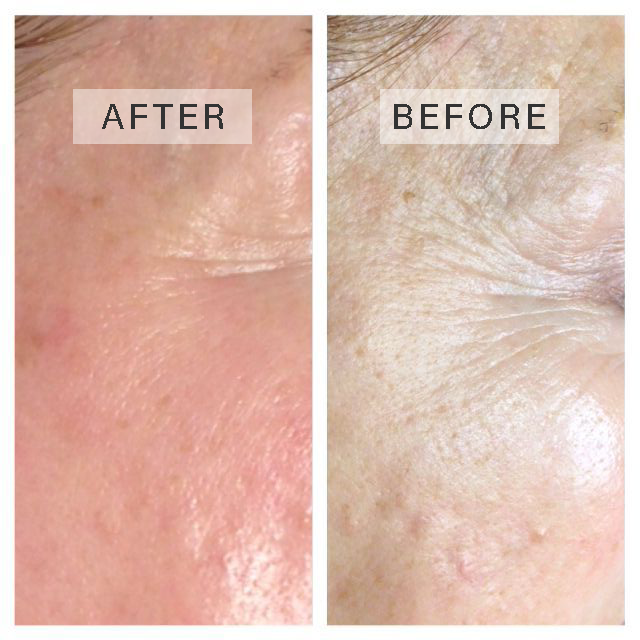 Before+and+After
