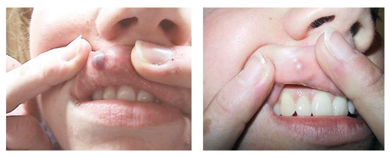 before-after-skin16